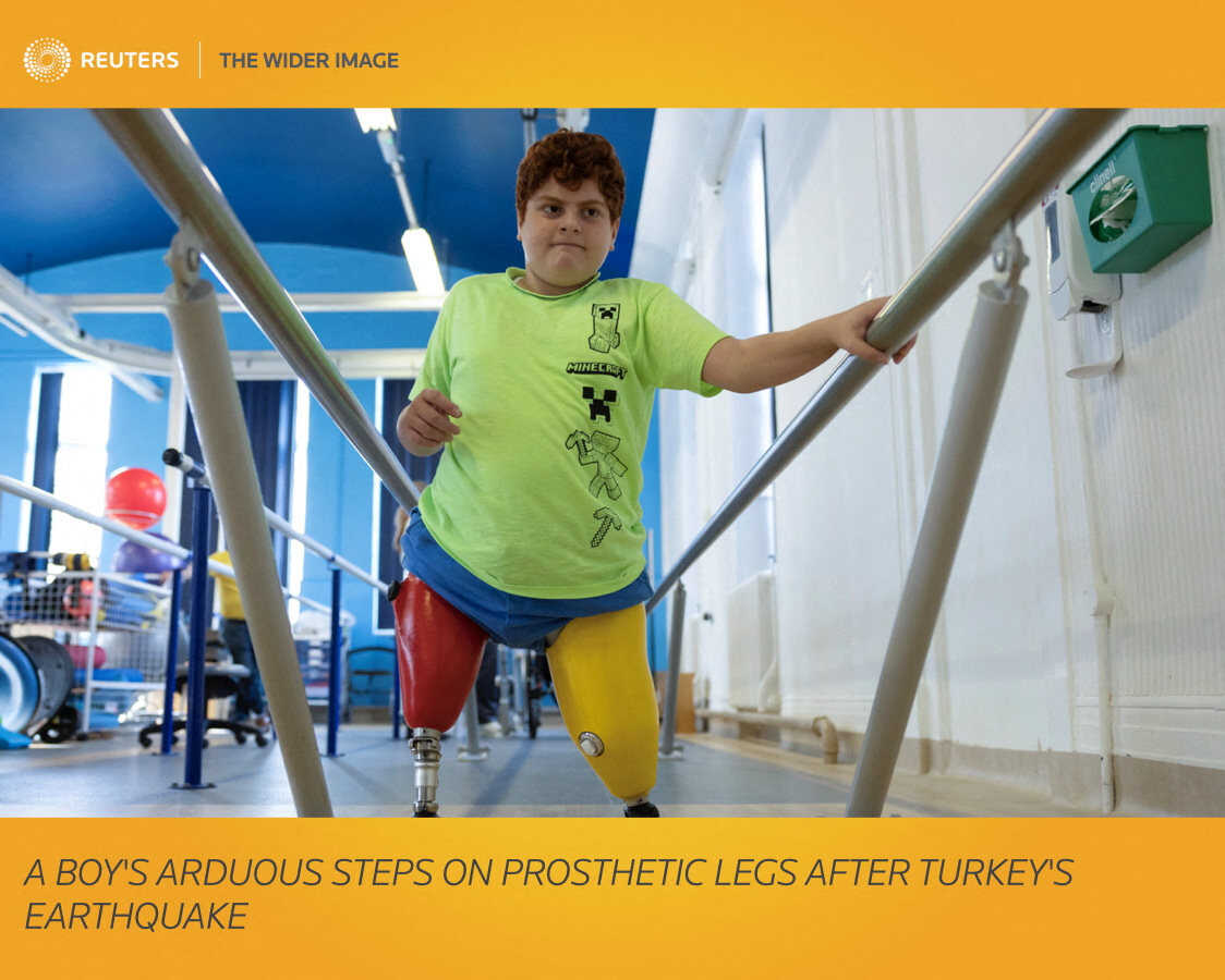 Mehmet Koc is still struggling to recover after he lost both legs in Turkey’s devastating earthquake last year. Photo: Reuters
