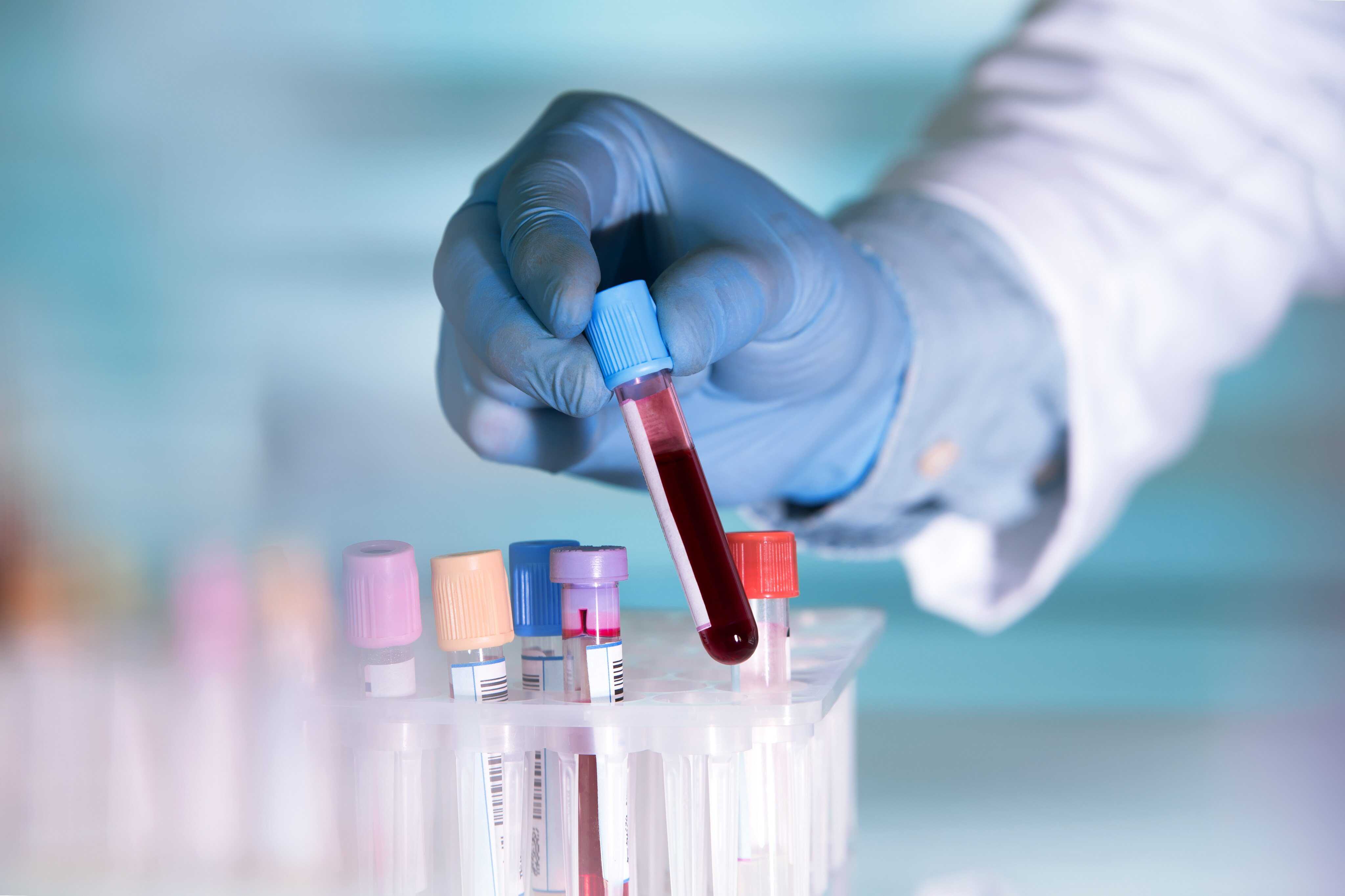 If your parents are B positive and A positive, there is a chance that you could be completely different with O negative blood. Photo: Shutterstock