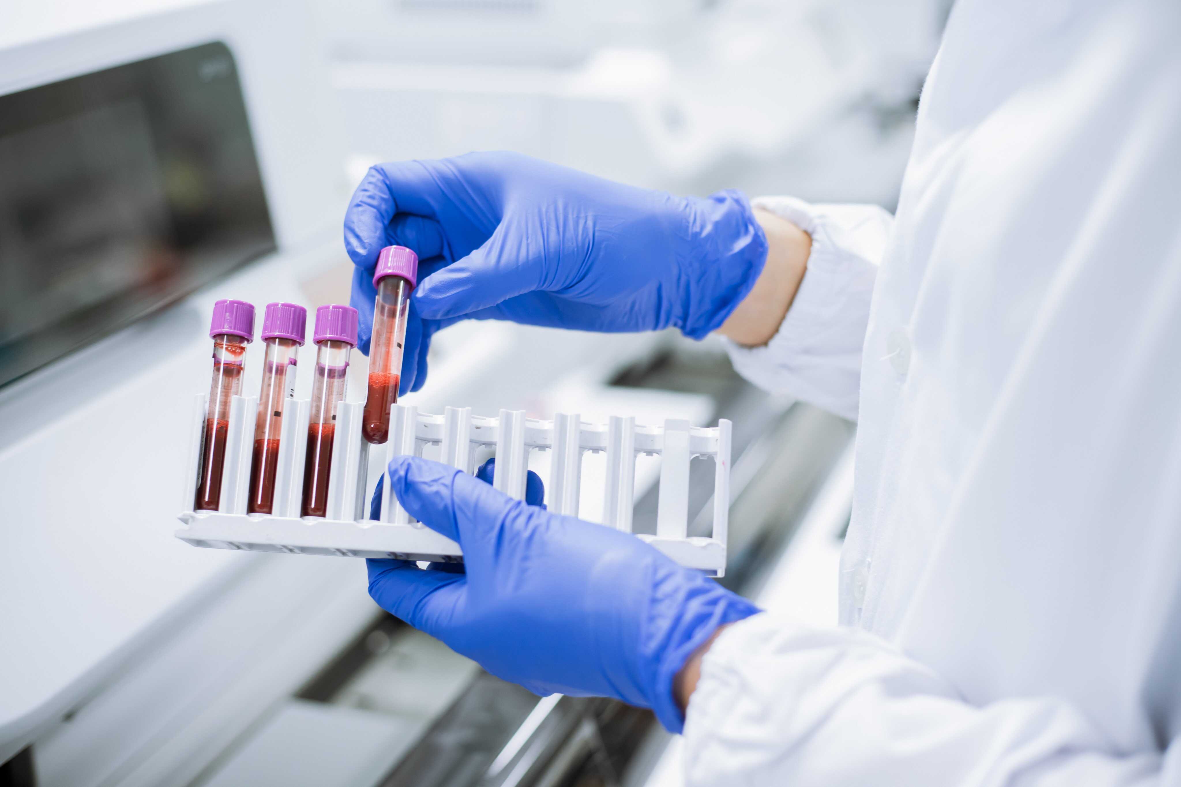 Your blood group is determined by the ABO system and the Rhesus system. Photo: Shutterstock
