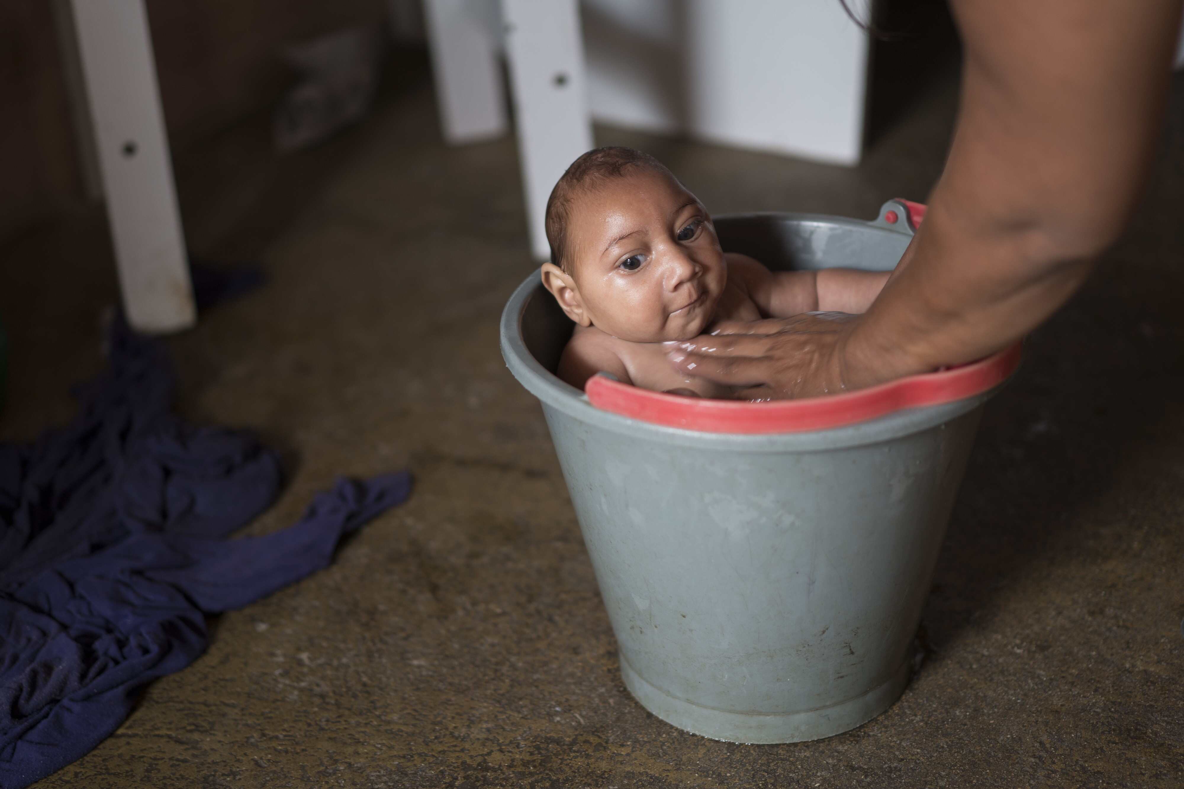 The Zika virus affects infants particularly severely.  