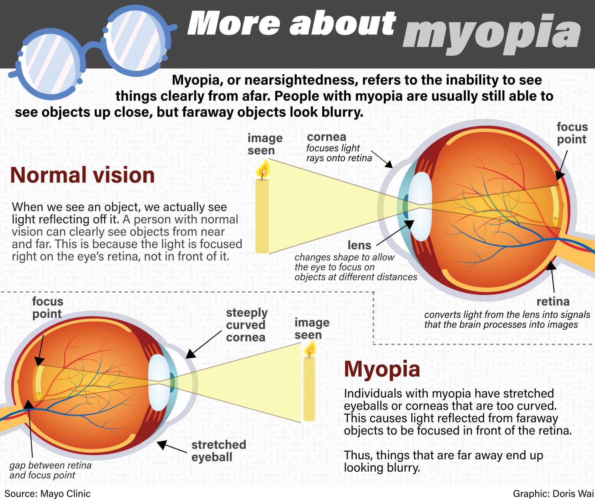 Visual and Refractive Outcomes Following Laser Blended Vision With  Non-linear Aspheric Micro-anisometropia (PRESBYOND) in Myopic and Hyperopic  Patients | Journal of Refractive Surgery, image size:1999x1676