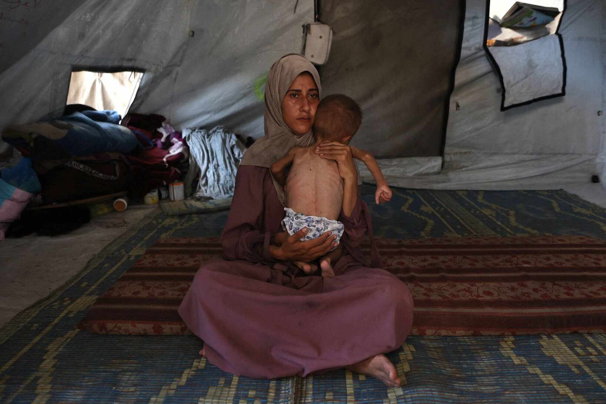 Hidaya, a 31-year-old Palestinian mother, cradles her sick 18-month-old son Mohammed al-Mutawaq, who is also displaying signs of malnutrition, inside their tent at the Al-Shati refugee camp. Photo: AFP
