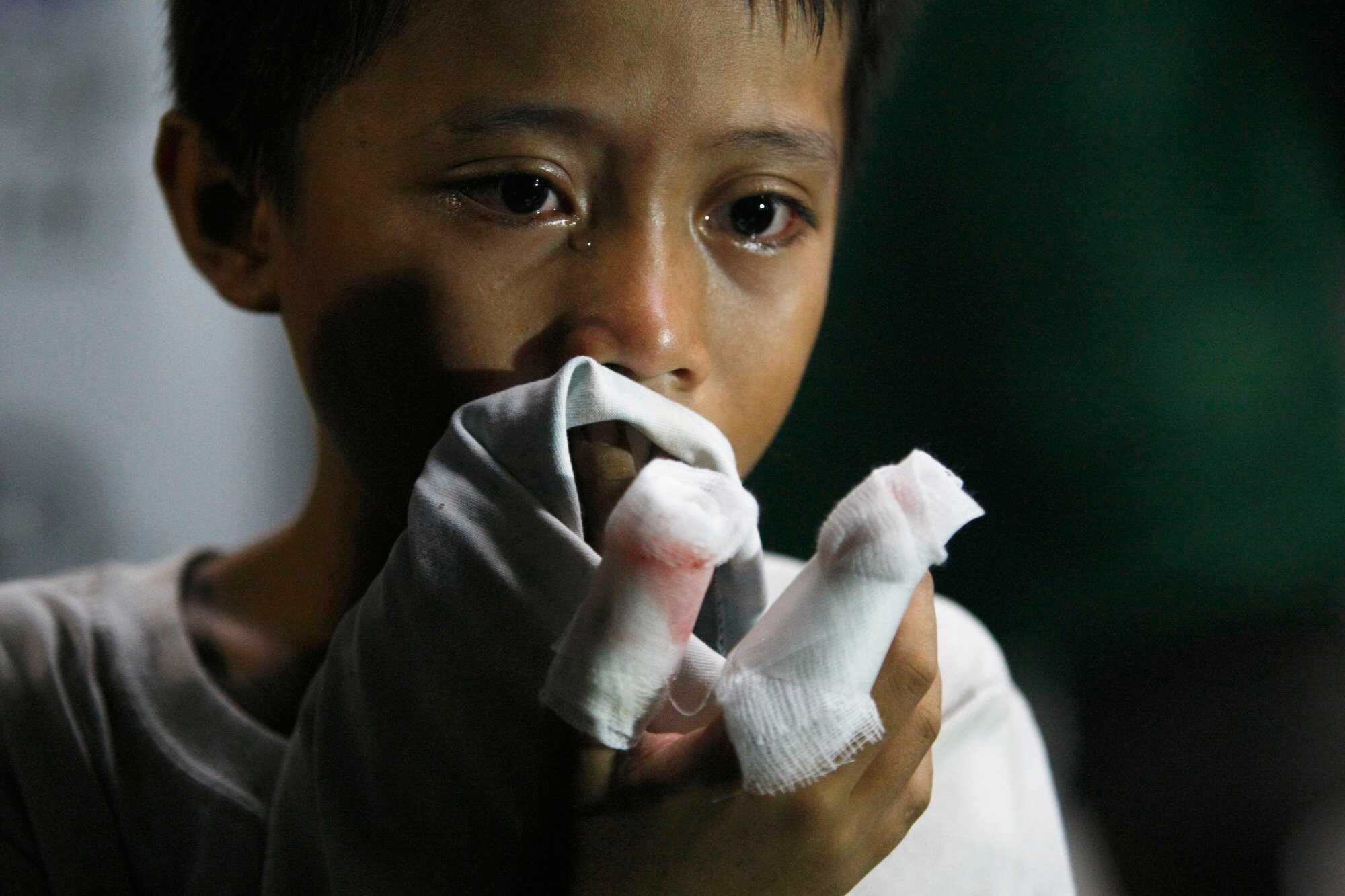 A boy is treated after being injured by a firecracker explosion on New Year’s Eve in Manila. Photo: AP