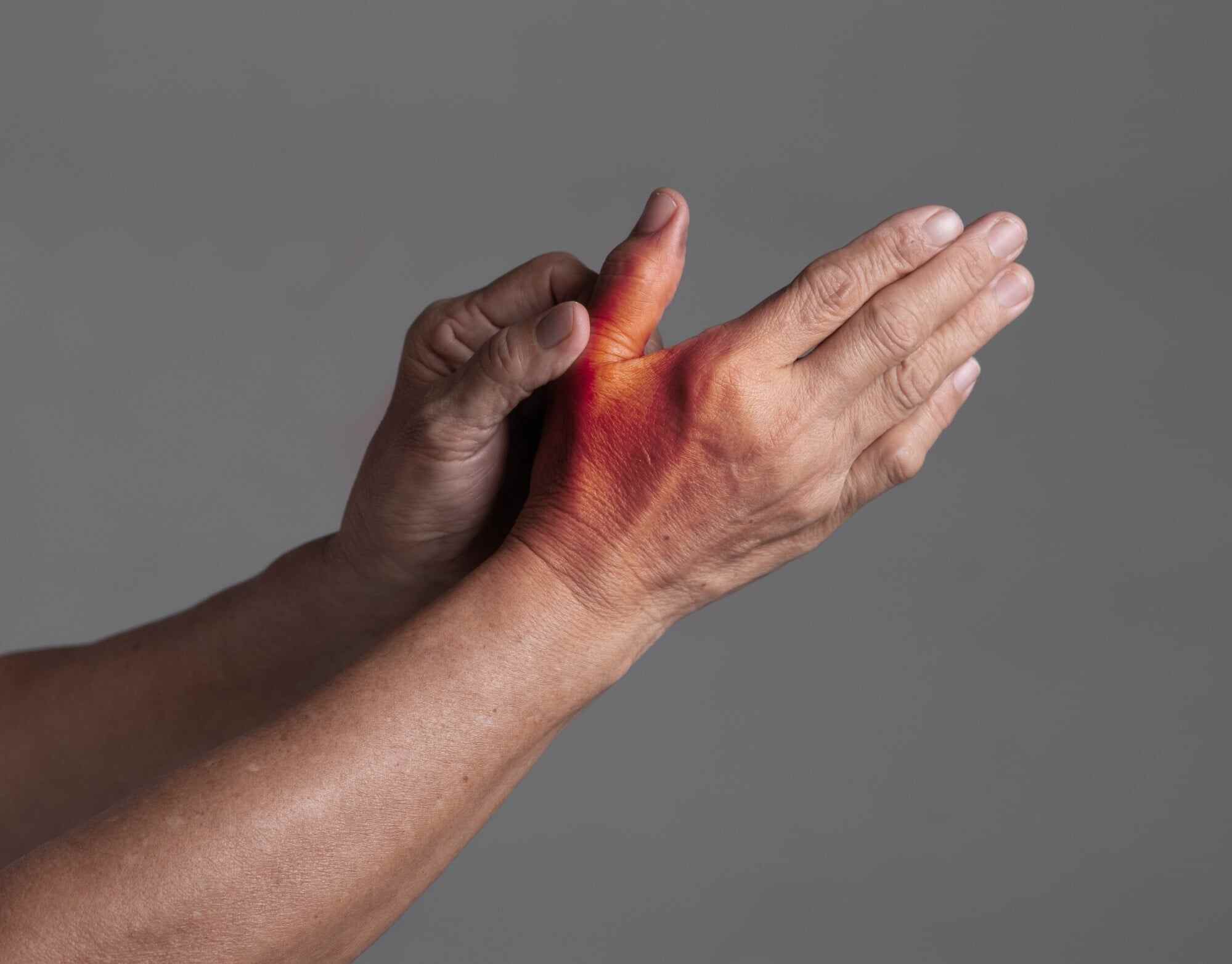 Rheumatic disorders are conditions that cause chronic pain in the joints or connective tissue. Photo: Shutterstock
